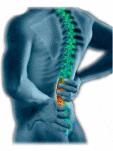 Low Back Pain